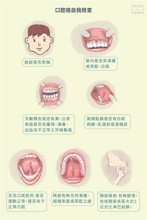 口腔內長起不知名的凸起物|口腔癌的自我檢查